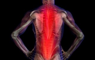 Musculoskeletal Pain