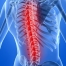 Risk Factors for Spinal Degeneration
